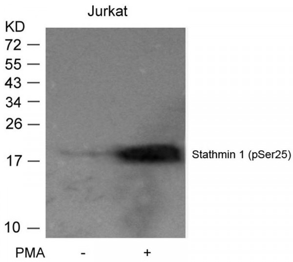 Anti-phospho-Stathmin 1 (Ser25)