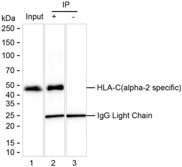 Anti-HLA-C Magnetic Beads