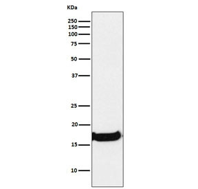 Anti-Uteroglobin / SCGB1A1, clone AEDA-19