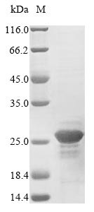 Nucleoside diphosphate kinase B (NME2), partial, human, recombinant