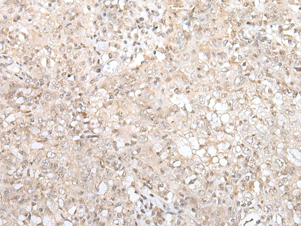 Anti-ZNF263