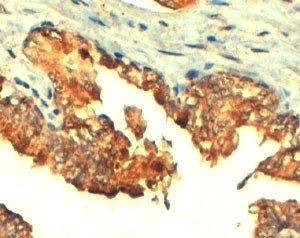 Anti-ABCC4