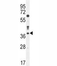 Anti-Caspase-3