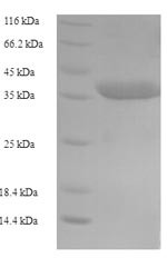 Caspase-5 (CASP5), partial, human, recombinant