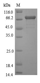 Genome polyprotein, partial, Yellow fever virus, recombinant