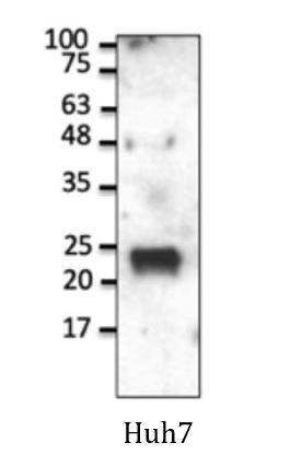 Anti-RAB1A