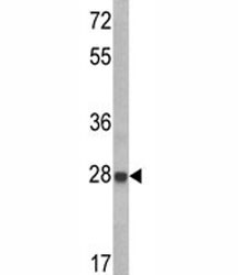 Anti-IGFBP6