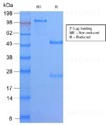 Anti-HLA-DQ (MHC II) Monoclonal Antibody (Clone: HLA-DQA1/2866R)