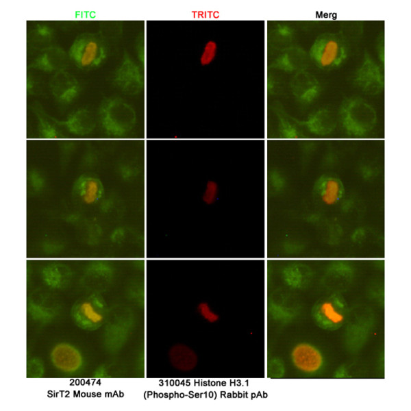 Anti-SIRT2