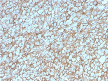 Anti-CD146 / MCAM / MUC18, clone MCAM/3048