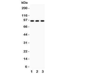 Anti-TBK1