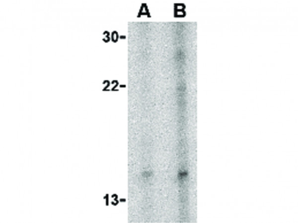 Anti-Neuritin