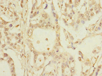 Anti-PKD2L2