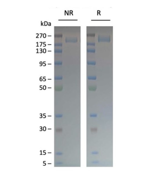 Spike Trimer (S1+S2) (BA.4.6, Omicron Variant), His-Tag (SARS-CoV-2) Recombinant