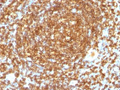 Anti-CD45RB (B-Cell Marker)(Clone: PTPRC/1132)
