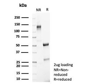 Anti-MR1 / MHC class I related protein 1, clone MR1/7577