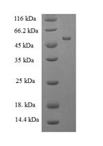 Muscleblind-like protein 1 (MBNL1), human, recombinant