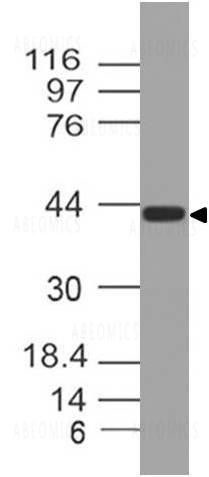 Anti-Wnt5A (Clone: ABM2A39)