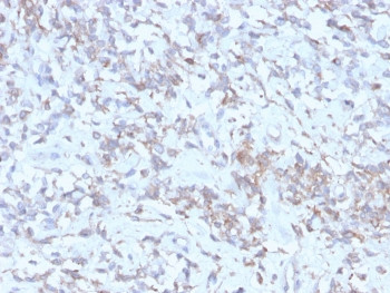 Anti-RBP / Retinol Binding Protein 1, clone rRBP1/872