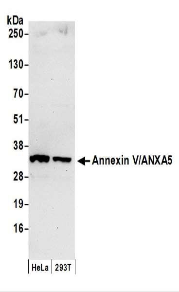 Anti-Annexin V/ANXA5