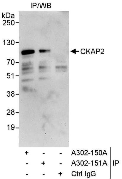 Anti-CKAP2