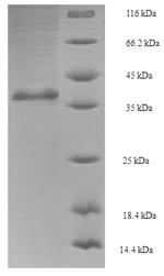 GTP-binding nuclear protein GSP1/CNR1 (GSP1), Saccharomyces cerevisiae, recombinant