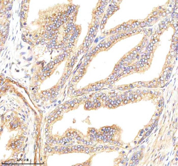 Anti-GBF1 / Golgi-specific brefeldin A-resistance factor 1