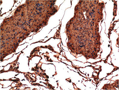 Anti-BAX Monoclonal