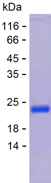 Recombinant Human CDKAL1 Protein