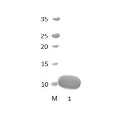 PDLIM7 PDZ Domain