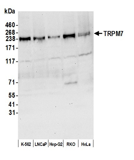 Anti-TRPM7