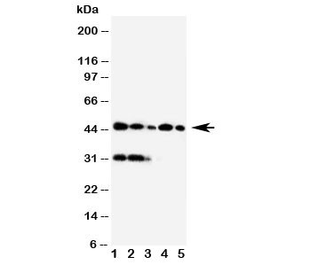 Anti-Haptoglobin
