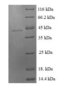 Growth/differentiation factor 9 (GDF9), human, recombinant