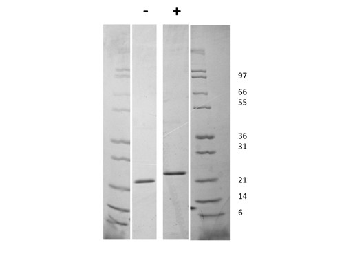 Fibroblast Growth Factor-21