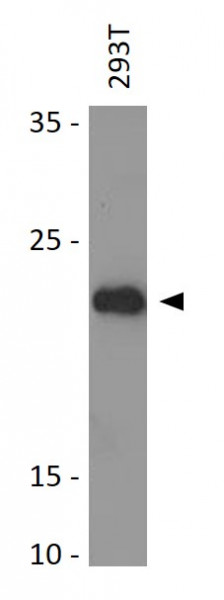 Anti-NHP2