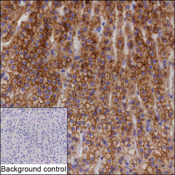 Anti-ABCB1