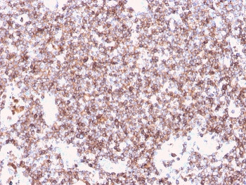 Anti-CD45 (Leukocyte marker), clone rPTPRC/1461