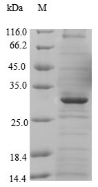 Major facilitator superfamily domain-containing protein 8 (MFSD8), partial, human, recombinant