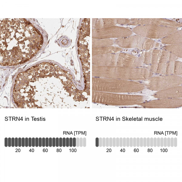 Anti-STRN4