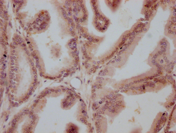 Anti-AR Monoclonal