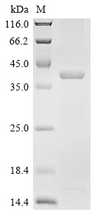 Aminopeptidase N (ANPEP), partial, swine, recombinant
