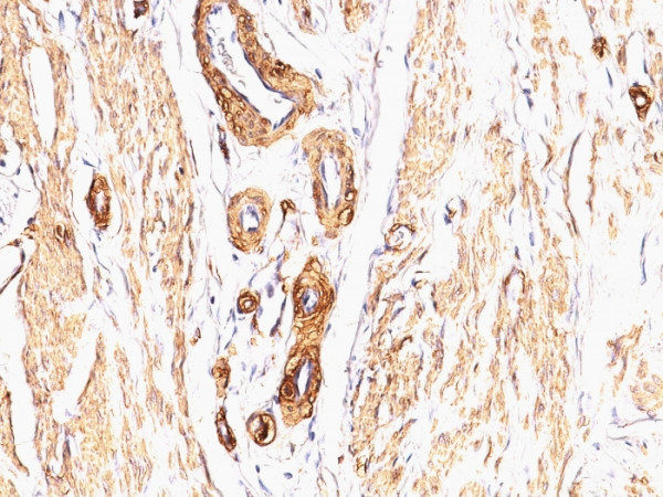 Anti-Actin, Smooth Muscle (Leiomyosarcoma Marker), clone SPM332