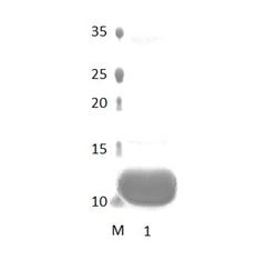 DLG4_1 PDZ Domain