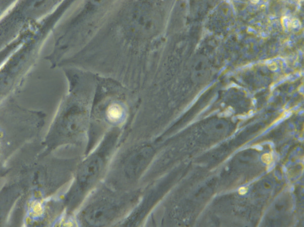HROG17 T1 M1 Cells