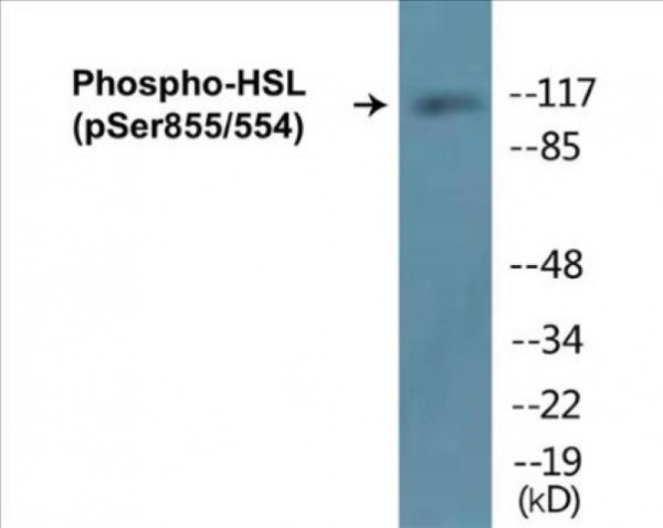 HSL (Phospho-Ser855/554) Colorimetric Cell-Based ELISA Kit