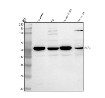 Anti-ACP2 / Lysosomal acid phosphatase 2