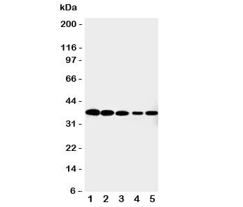 Anti-Cdk7