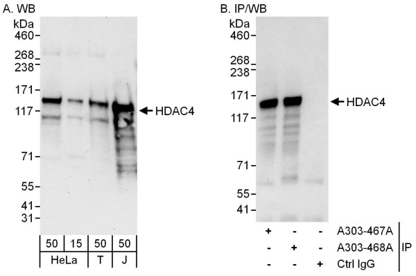 Anti-HDAC4