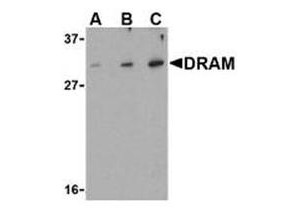 Anti-DRAM (Damage Related Autophagy Modulator)