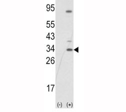 Anti-SNAI1